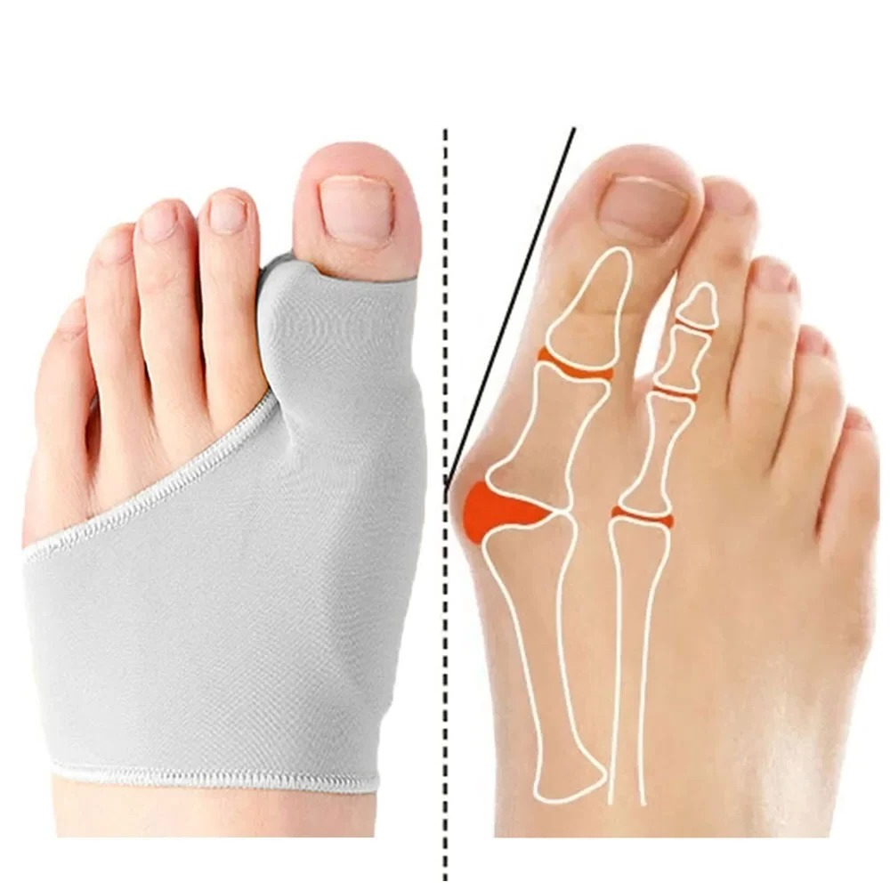 1/2Pair Toe Separator Hallux V - Ankle Brace Sock のレビューと価格